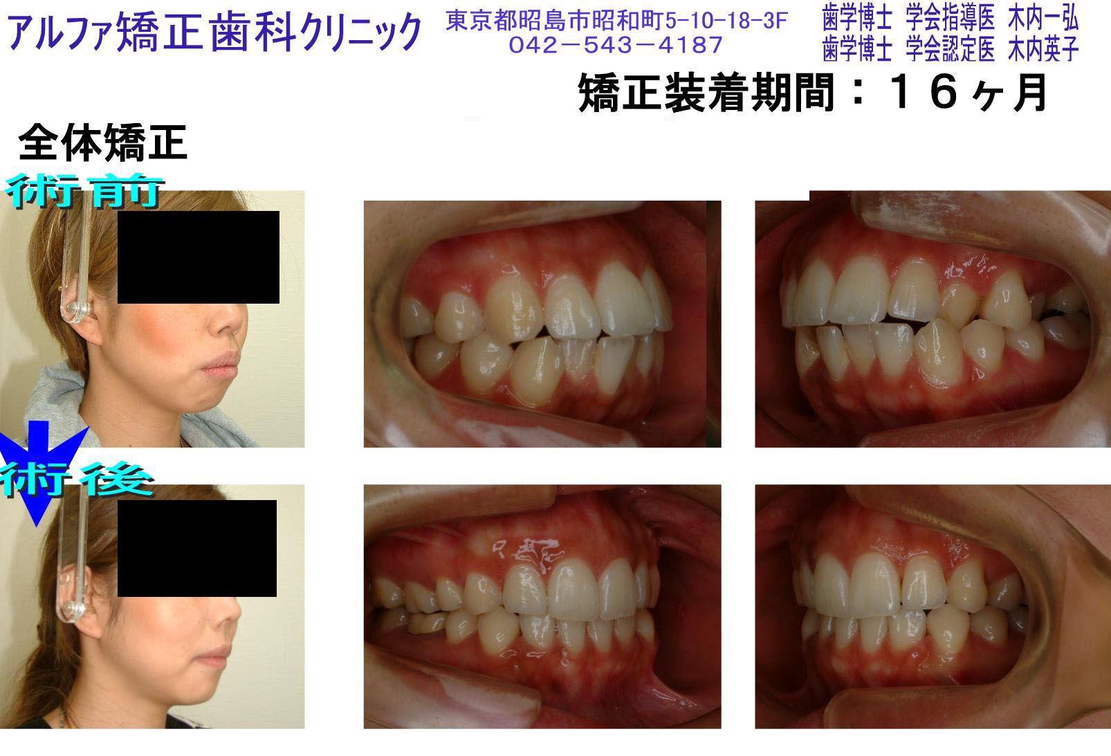 症例紹介の外観